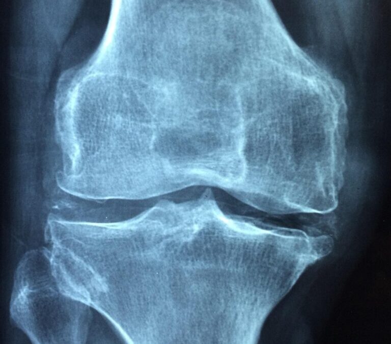 Cartilage | The Amazing, Flexible Stuff Inside You: All About…
