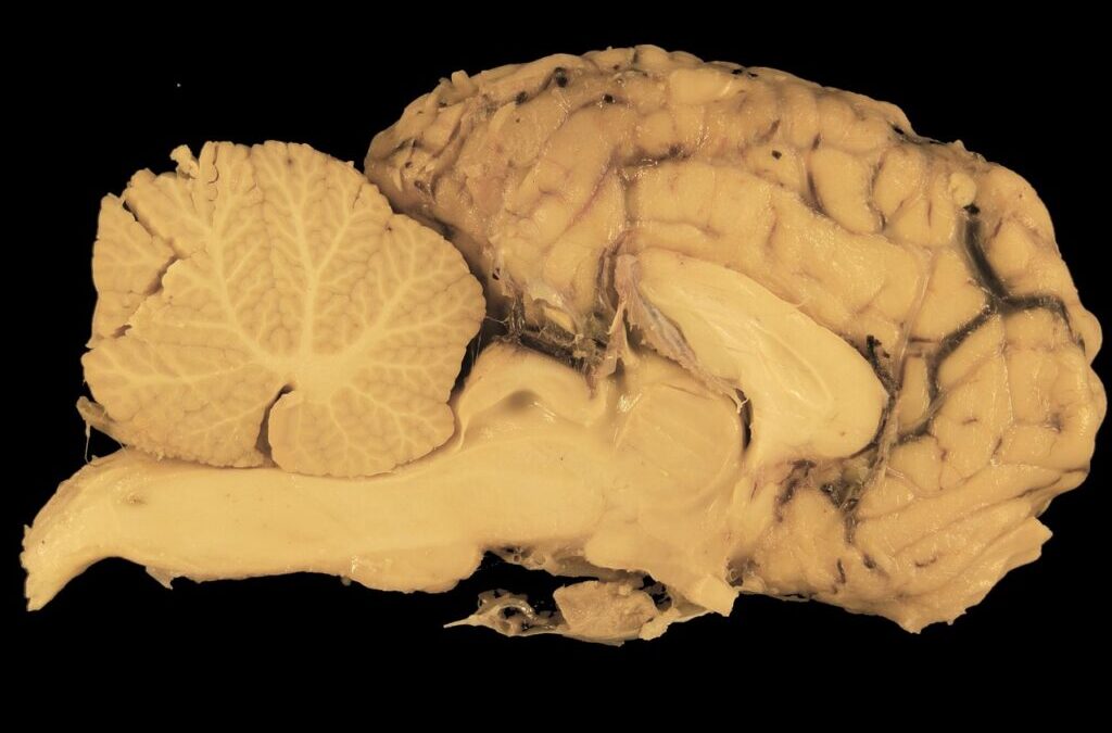 Cerebrum – Your Brain’s Command Center: The Cerebrum TL;DR: The…
