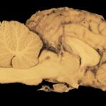 Cerebrum_and_Giving-Back-1024×682-1