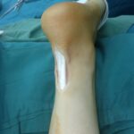 Tendons_and_Spicy-spice-mix-for-chicken-768×1024-1